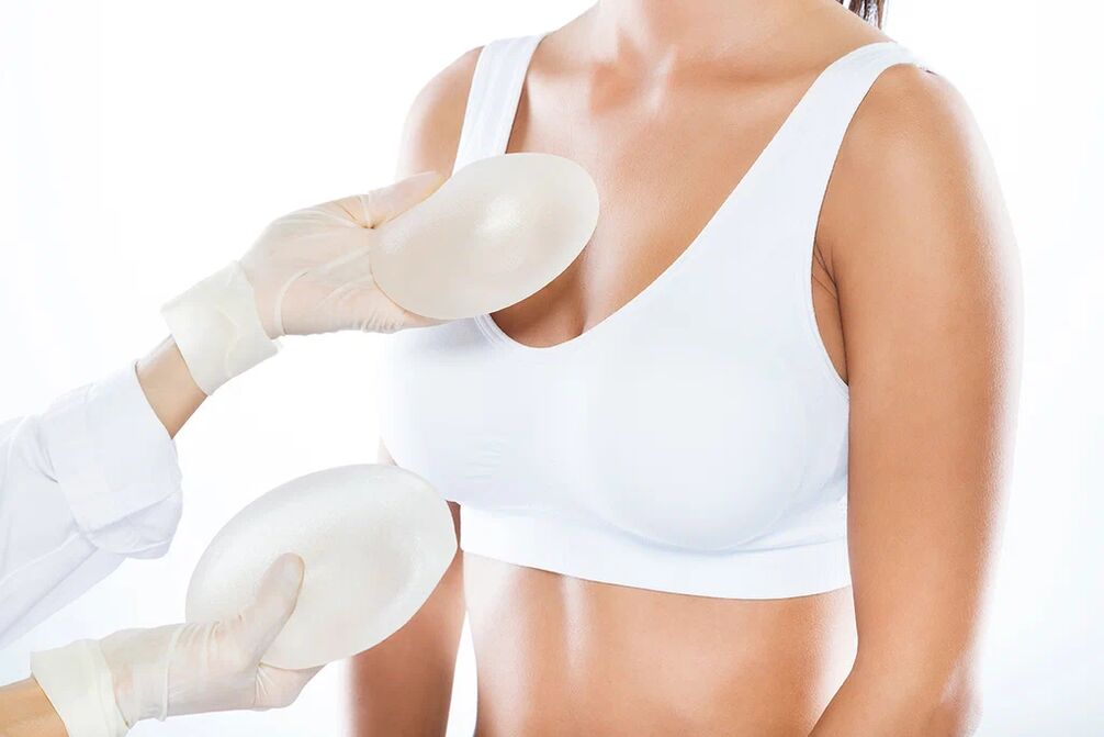 Selectarea implanturilor înainte de operația de mărire a sânilor