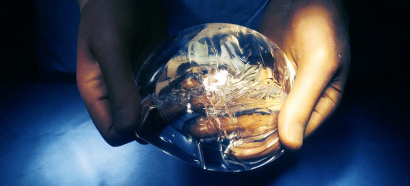 Endoproteză din silicon